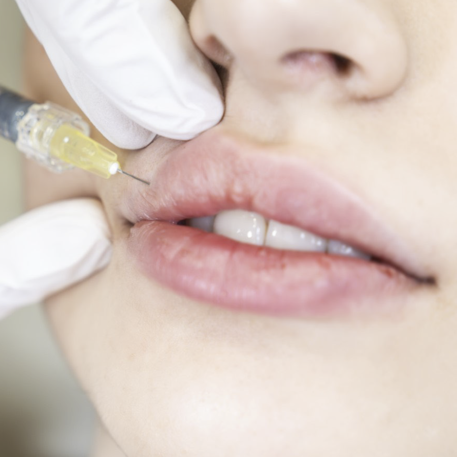 cirugía, rejuvenecimiento, facial, no quirúrgico, fillers